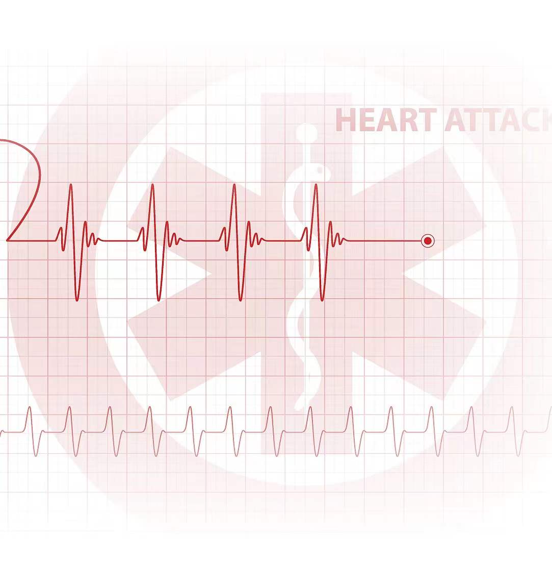 奧泰康服務于創新前沿-PartIV：心臟外科