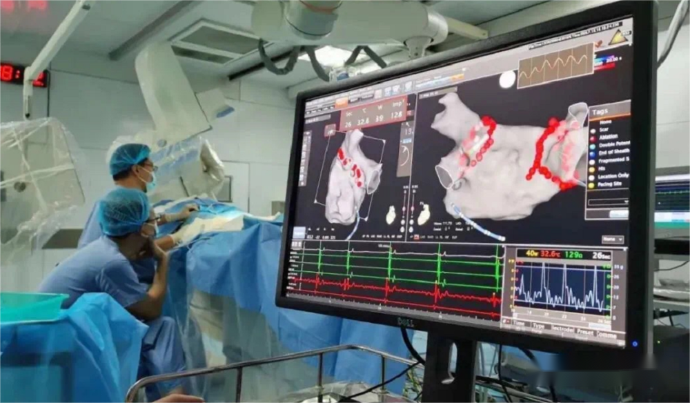 術中超聲成像新技術|心腔內超聲（ICE）③臨床應用篇
